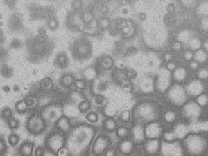 コロナウイルスで学校休校だが学童は？人員確保は間に合うの？1